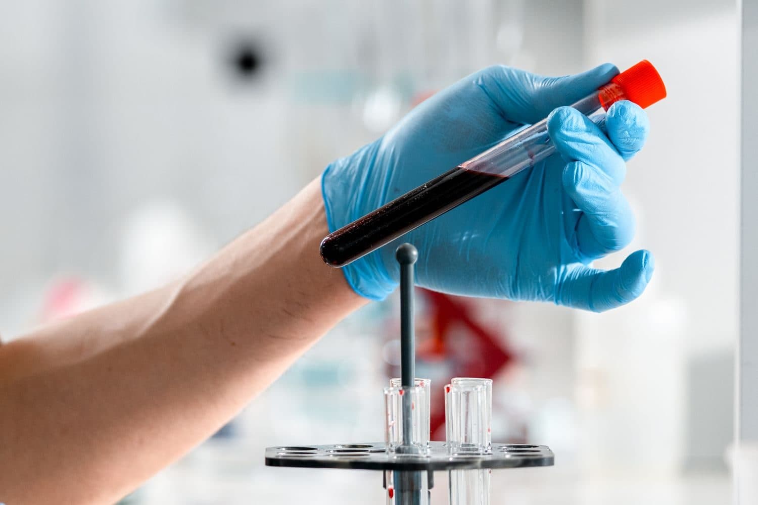 Lab Work